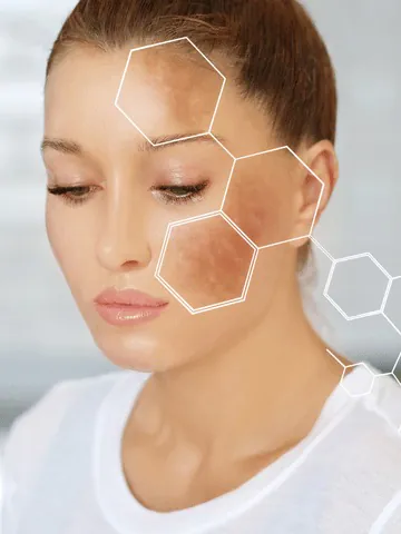 Dark Spot Serum